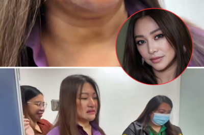 Rufa Mae Quinto Spends the Night at NBI, Opens Up About the Cause of Her Chin Bruise